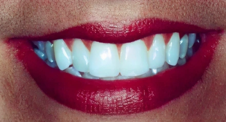 Close-up of smiling mouth displaying white teeth with bright red lipstick applied.