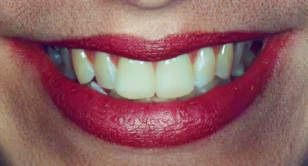 Close-up of a person's smile displaying teeth and bright pink lipstick application.